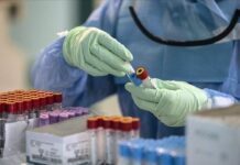 Регистрирани 899 нови случаи на КОВИД-19 во последните 3 дена ковид