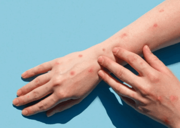 мајмунски сипаници