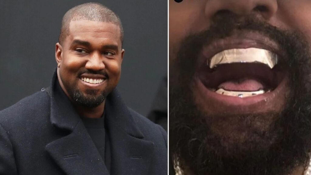 Kanye West Titanium dentures