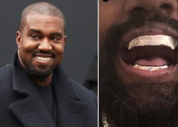 Кање Вест уште еднаш ја шокираше јавноста – ги извади сите заби и ги замени со титаниумски протези