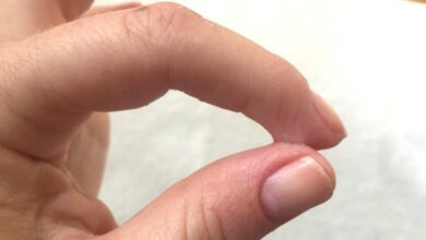 како да го отстраните супер лепилото од која било површина