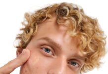 Како го надминав проблемот со акните: Искуството на еден тинејџер