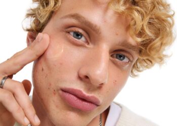 Како го надминав проблемот со акните: Искуството на еден тинејџер